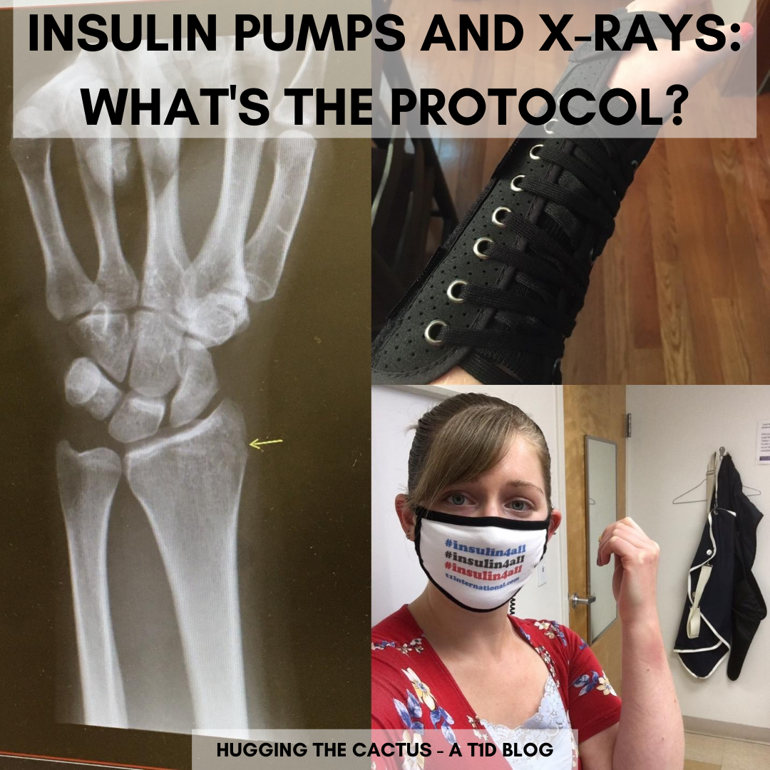 Insulin Pumps and X-Rays_ What's the Protocol_